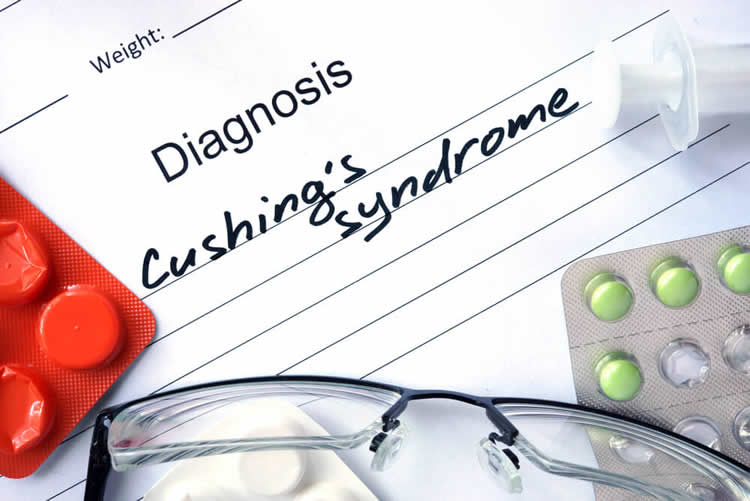 Medical notepad with diagnosis for cushing's disease